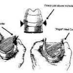 Heel Counter Rigidity - Pinch Test | Rebalance Sports Medicine Heel Counter Rigidity - Pinch Test